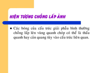 Hieän töôïng choàng laáp aûnh
 Caùc boùng cuûa caáu truùc giaûi phaãu bình thöôøng
choàng laáp leân vuøng quanh choùp coù theå laø thaáu
quanh hay caûn quang tuøy vaøo caáu truùc lieân quan.
 