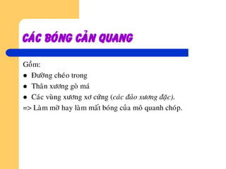Caùc boùng caûn quang
Goàm:
 Ñöôøng cheùo trong
 Thaân xöông goø maù
 Caùc vuøng xöông xô cöùng (caùc ñaûo xöông ñaëc).
=> Laøm môø hay laøm maát boùng cuûa moâ quanh choùp.
 