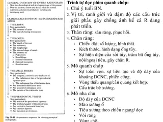 Trình töï ñoïc phim quanh choùp:
1. Chuù yù tuoåi BN.
2. Vò trí, ranh giôùi vaø ñaäm ñoä caùc caáu truùc
giaûi phaãu gaây choàng aûnh keå caû R ñang
phaùt trieån.
3. Thaân raêng: saâu raêng, phuïc hoài.
4. Chaân raêng:
• Chieàu daøi, soá löôïng, hình thaùi.
• Kích thöôùc, hình daïng oáng tuûy.
• Söï hieän dieän cuûa soûi tuûy, traùm bít oáng tuûy,
noäi/ngoaïi tieâu, gaõy chaân R.
5. Moâ quanh choùp
• Söï toaøn veïn, söï lieân tuïc vaø ñoä daøy cuûa
khoaûng DCNC, phieán cöùng.
• Vuøng thaáu quang/caûn quang keát hôïp.
• Caáu truùc beø xöông.
6. Moâ nha chu
• Ñoä daøy cuûa DCNC
• Maøo xöông oå
• Tieâu xöông theo chieàu ngang/ doïc
• Voâi raêng
 