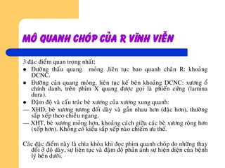 Moâ quanh choùp cuûa r vónh vieãn
3 ñaëc ñieåm quan troïng nhaát:
 Ñöôøng thaáu quang moûng ,lieân tuïc bao quanh chaân R: khoaûng
DCNC.
 Ñöôøng caûn quang moûng, lieân tuïc keá beân khoaûng DCNC: xöông oå
chính danh, treân phim X quang ñöôïc goïi laø phieán cöùng (lamina
dura).
 Ñaäm ñoä vaø caáu truùc beø xöông cuûa xöông xung quanh:
— XHD, beø xöông töông ñoái daøy vaø gaàn nhau hôn (ñaëc hôn), thöôøng
saép xeáp theo chieàu ngang.
— XHT, beø xöông moûng hôn, khoaûng caùch giöõa caùc beø xöông roäng hôn
(xoáp hôn). Khoâng coù kieåu saép xeáp naøo chieám öu theá.
Caùc ñaëc ñieåm naøy laø chìa khoùa khi ñoïc phim quanh choùp do nhöõng thay
ñoåi ôû ñoä daøy, söï lieân tuïc vaø ñaäm ñoä phaûn aùnh söï hieän dieän cuûa beänh
lyù beân döôùi.
 
