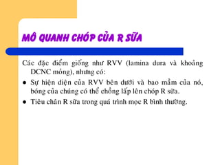Moâ quanh choùp cuûa r söõa
Caùc ñaëc ñieåm gioáng nhö RVV (lamina dura vaø khoaûng
DCNC moûng), nhöng coù:
 Söï hieän dieän cuûa RVV beân döôùi vaø bao maàm cuûa noù,
boùng cuûa chuùng coù theå choàng laáp leân choùp R söõa.
 Tieâu chaân R söõa trong quaù trình moïc R bình thöôøng.
 