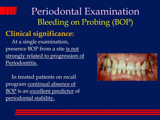 The periodontal examination_and_diagnosis_lec 1 | PDF