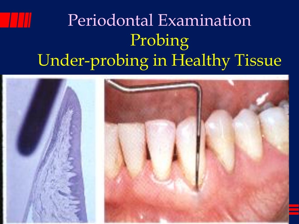 The periodontal examination_and_diagnosis_lec 1