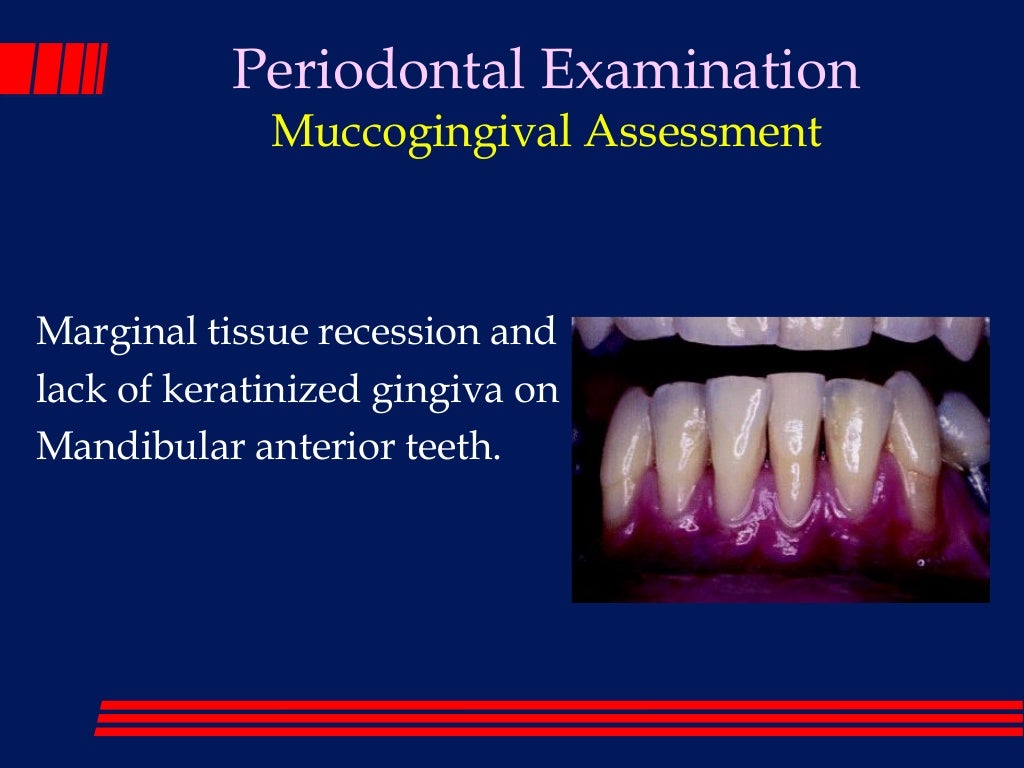 The periodontal examination_and_diagnosis_lec 1