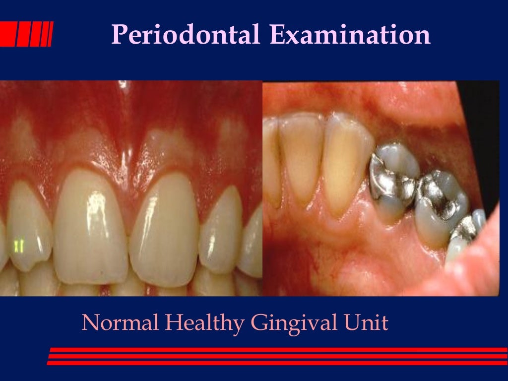 The periodontal examination_and_diagnosis_lec 1