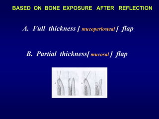 THE PERIODONTAL FLAP.ppt