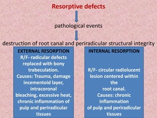 Resorptive defects
pathological events
destruction of root canal and periradicular structural integrity
EXTERNAL RESORPTION
R/F- radicular defects
replaced with bony
trabeculation.
Causes: Trauma, damage in
cementoid layer, intracoronal
bleaching, excessive heat,
chronic inflammation of pulp
and periradicular tissues
EXTERNAL RESORPTION
R/F- radicular defects
replaced with bony
trabeculation.
Causes: Trauma, damage
incementoid layer,
intracoronal
bleaching, excessive heat,
chronic inflammation of
pulp and periradicular
tissues
INTERNAL RESORPTION
R/F- circular radiolucent
lesion centered within
the
root canal.
Causes: chronic
inflammation
of pulp and periradicular
tissues
 