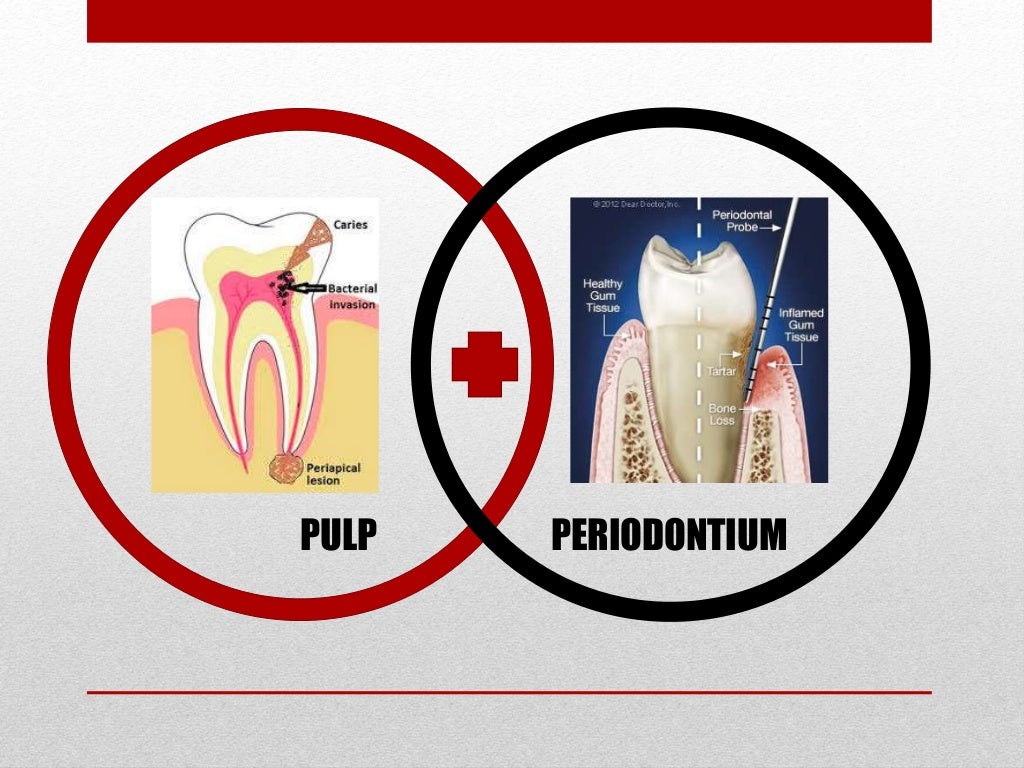 Perio Endo InterRelationship