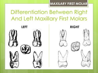 MAXILARY FIRST MOLAR

Differentiation Between Right
And Left Maxillary First Molars
    LEFT                 RIGHT
 