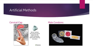 Artificial Methods
Cervical Cap Male Condoms
 