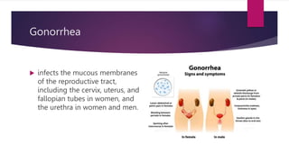 Gonorrhea
 infects the mucous membranes
of the reproductive tract,
including the cervix, uterus, and
fallopian tubes in women, and
the urethra in women and men.
 