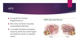 HPV
 It stands for Human
Papillomavirus.
 the most common sexually
transmitted infection.
 is usually harmless and goes
away by itself, but some types
can lead to cancer or genital
warts.
 