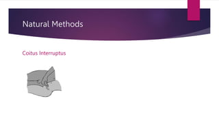 Natural Methods
Coitus Interruptus
 