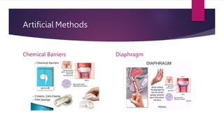 Artificial Methods
Chemical Barriers Diaphragm
 