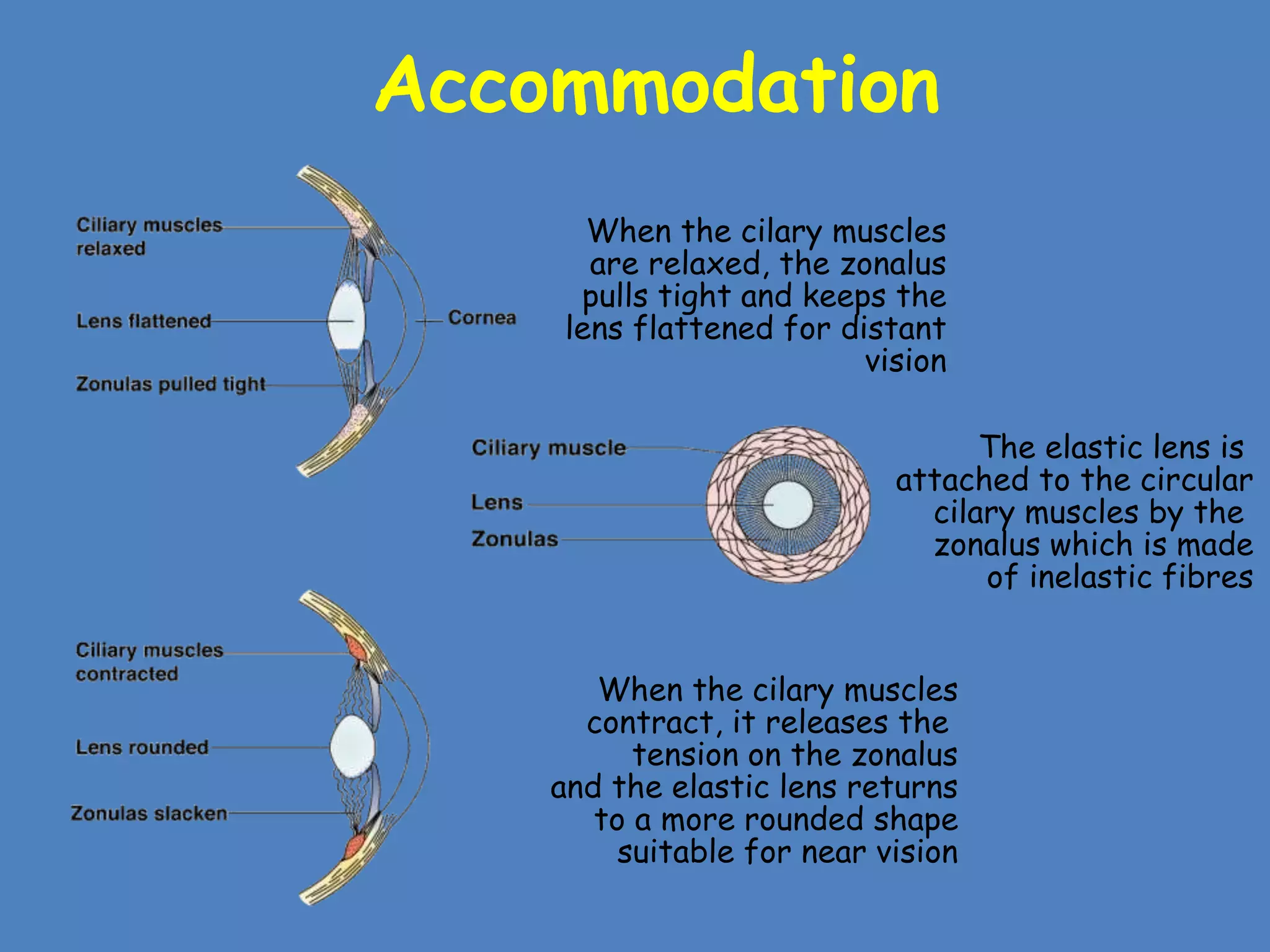 Accommodation
The elastic lens is
attached to the circular
cilary muscles by the
zonalus which is made
of inelastic fibres
When the cilary muscles
are relaxed, the zonalus
pulls tight and keeps the
lens flattened for distant
vision
When the cilary muscles
contract, it releases the
tension on the zonalus
and the elastic lens returns
to a more rounded shape
suitable for near vision
 