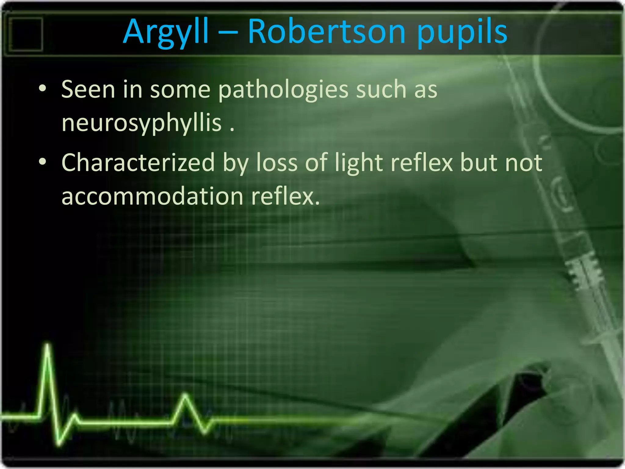 Argyll – Robertson pupils
• Seen in some pathologies such as
neurosyphyllis .
• Characterized by loss of light reflex but not
accommodation reflex.
 