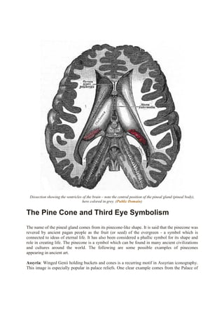 Dissection showing the ventricles of the brain – note the central position of the pineal gland (pineal body),
here colored in grey. (Public Domain)
The Pine Cone and Third Eye Symbolism
The name of the pineal gland comes from its pinecone-like shape. It is said that the pinecone was
revered by ancient pagan people as the fruit (or seed) of the evergreen - a symbol which is
connected to ideas of eternal life. It has also been considered a phallic symbol for its shape and
role in creating life. The pinecone is a symbol which can be found in many ancient civilizations
and cultures around the world. The following are some possible examples of pinecones
appearing in ancient art.
Assyria: Winged Genii holding buckets and cones is a recurring motif in Assyrian iconography.
This image is especially popular in palace reliefs. One clear example comes from the Palace of
 