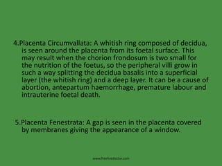 4.Placenta Circumvallata: A whitish ring composed of decidua, is seen around the placenta from its foetal surface. This may result when the chorionfrondosum is two small for the nutrition of the foetus, so the peripheral villi grow in such a way splitting the deciduabasalis into a superficial layer (the whitish ring) and a deep layer. It can be a cause of abortion, antepartumhaemorrhage, premature labour and intrauterine foetal death. 5.Placenta Fenestrata: A gap is seen in the placenta covered by membranes giving the appearance of a window.www.freelivedoctor.com