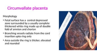 Chorionic Ring The Placenta xcxcxvxvxcxzczxxzxzczxzzsds | PPTX