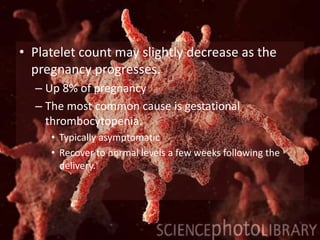 • Platelet count may slightly decrease as the
pregnancy progresses.
– Up 8% of pregnancy
– The most common cause is gestational
thrombocytopenia.
• Typically asymptomatic
• Recover to normal levels a few weeks following the
delivery.
 