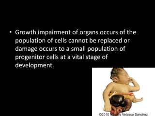 • Growth impairment of organs occurs of the
population of cells cannot be replaced or
damage occurs to a small population of
progenitor cells at a vital stage of
development.
 