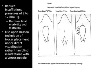 • Reduce
insufflations
pressures of 8 to
12 mm Hg.
– Decrease fetal
morbidity and
mortality.
• Use open Hasson
technique of
trocar placement
under direct
visualization
rather than blind
insufflations with
a Veress needle.
 