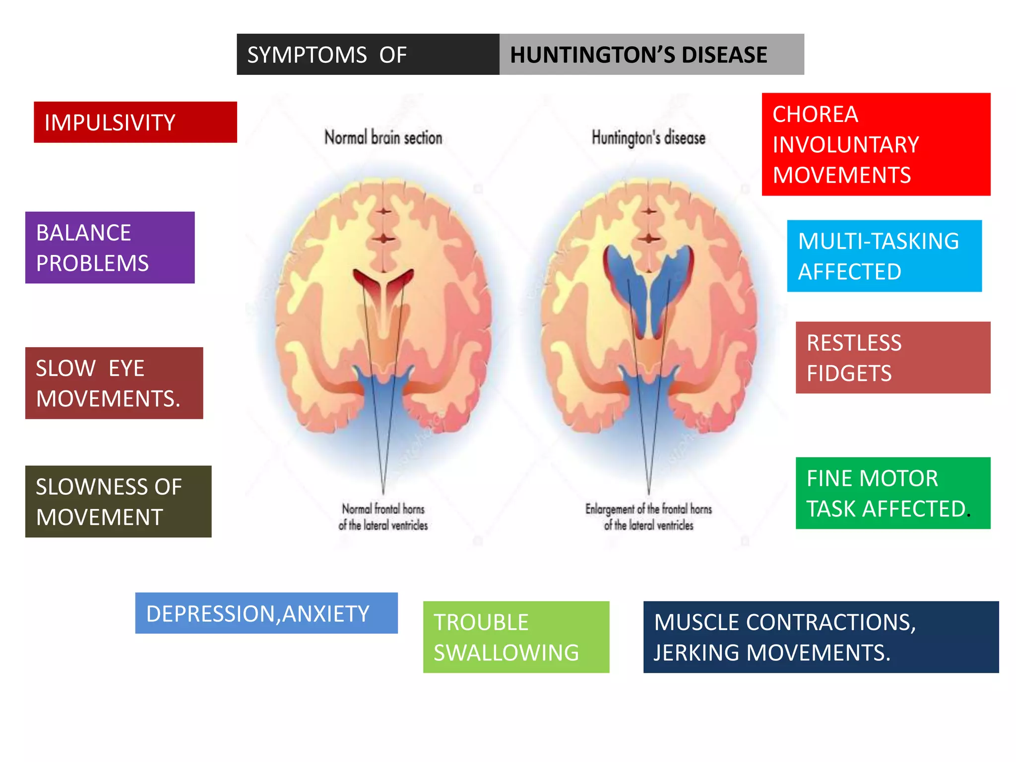 HUNTINGTON’S DISEASE
IMPULSIVITY
BALANCE
PROBLEMS
SLOW EYE
MOVEMENTS.
SLOWNESS OF
MOVEMENT
DEPRESSION,ANXIETY TROUBLE
SWALLOWING
MUSCLE CONTRACTIONS,
JERKING MOVEMENTS.
FINE MOTOR
TASK AFFECTED.
RESTLESS
FIDGETS
MULTI-TASKING
AFFECTED
CHOREA
INVOLUNTARY
MOVEMENTS
SYMPTOMS OF
 