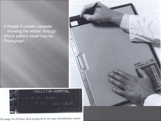 A Kodak X-omatic cassette
showing the widow through
Which patient detail may be
Photograph.

 