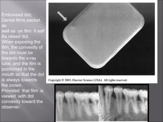 Embossed dot;
Dental films packet,
as
well as on film it self
As raised dot.
When exposing the
film, the convexity of
the dot must be
towards the x-ray
tube, and the film is
positioned in the
mouth so that the dot
is always towards
the crown.
Provided that film is
viewed with dot
convexity toward the
observer.

 
