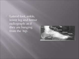 

Lateral foot, ankle,
lower leg and femur
radiograph: as if
they are hanging
from the hip.

 