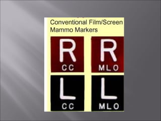 The presentation of radiograph