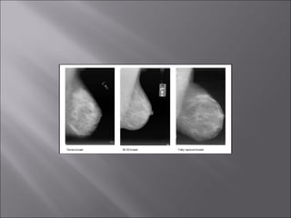 The presentation of radiograph