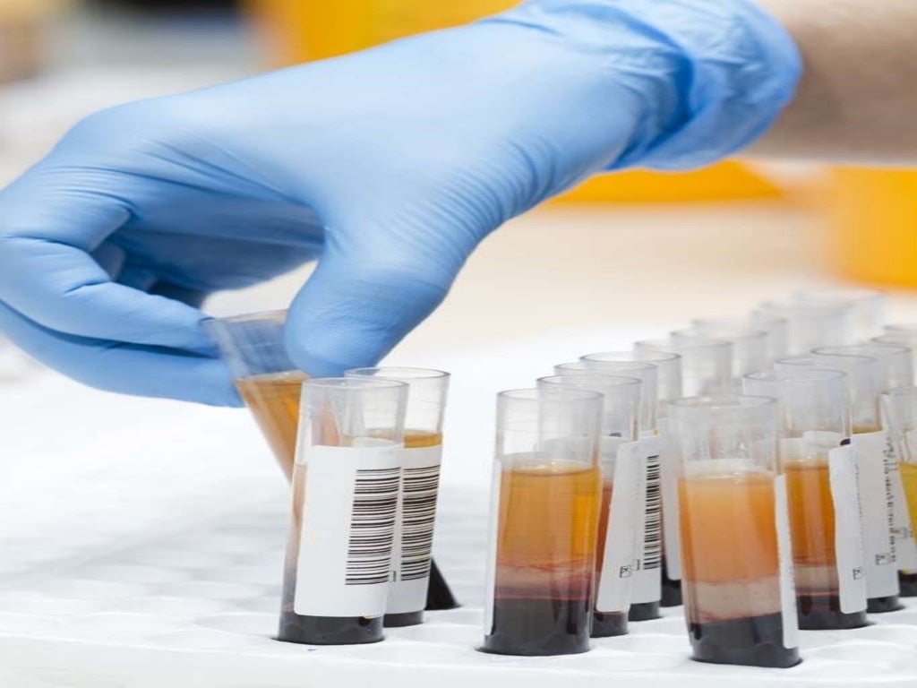 enzymes as diagnostic tools