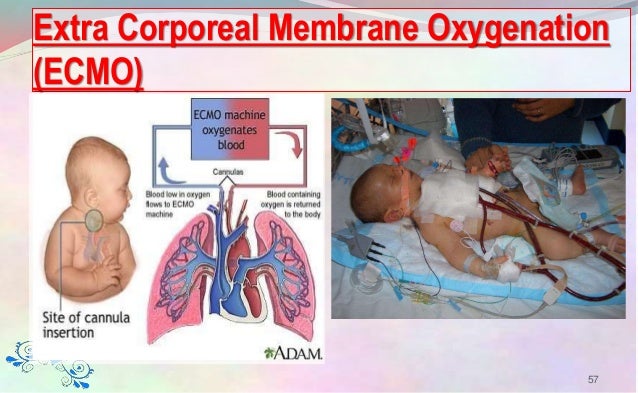The preterm infant