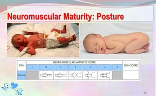 Neuromuscular Maturity: Posture
13
 