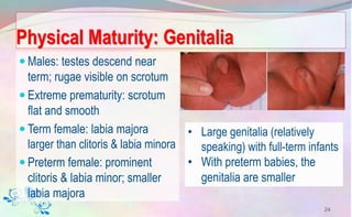 Physical Maturity: Genitalia
 Males: testes descend near
term; rugae visible on scrotum
 Extreme prematurity: scrotum
flat and smooth
 Term female: labia majora
larger than clitoris & labia minora
 Preterm female: prominent
clitoris & labia minor; smaller
labia majora
24
• Large genitalia (relatively
speaking) with full-term infants
• With preterm babies, the
genitalia are smaller
 