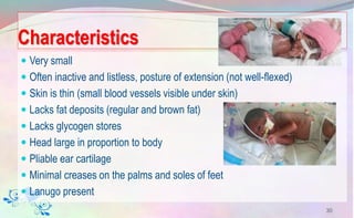 Characteristics
 Very small
 Often inactive and listless, posture of extension (not well-flexed)
 Skin is thin (small blood vessels visible under skin)
 Lacks fat deposits (regular and brown fat)
 Lacks glycogen stores
 Head large in proportion to body
 Pliable ear cartilage
 Minimal creases on the palms and soles of feet
 Lanugo present
30
 