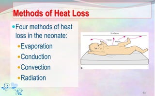 Methods of Heat Loss
Four methods of heat
loss in the neonate:
Evaporation
Conduction
Convection
Radiation
63
 