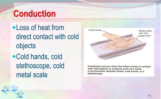 Conduction
Loss of heat from
direct contact with cold
objects
Cold hands, cold
stethoscope, cold
metal scale
65
 