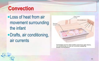 Convection
Loss of heat from air
movement surrounding
the infant
Drafts, air conditioning,
air currents
66
 