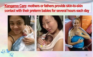 KangarooCare:mothersorfathersprovideskin-to-skin
contactwiththeirpretermbabiesforseveralhourseachday
85
 