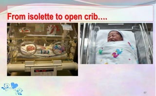 From isolette to open crib….
87
 