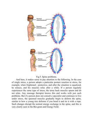 Fig.5. Spine problems.
And here, it makes sense to pay attention to the following. In the case
of single stress, a person adopts a particular posture reaction to stress, for
example, when frightened - protective, and after the situation is equalized,
he relaxes, and his muscles relax after a while. If a person regularly
experiences the same type of stress, the tense back muscles spasm and do
not relax. Any massage therapist knows this and works with just such
problems. But if a person does not consult a specialist and continues to live
under stress, the spasmed muscles gradually begin to deform the spine,
similar to how a young tree deforms if you bend it and tie it with a rope.
Such changes disrupt the normal energy exchange in the spine, and this is
very clearly seen in the Bio-gram and Energy Field.
 