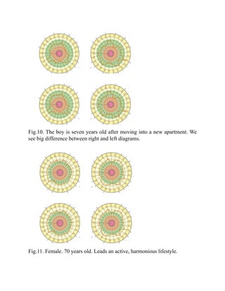 Fig.10. The boy is seven years old after moving into a new apartment. We
see big difference between right and left diagrams.
Fig.11. Female. 70 years old. Leads an active, harmonious lifestyle.
 