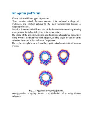 Bio-gram patterns
We can define different types of patterns:
Glow emission outside the outer contour. It is evaluated in shape, size,
brightness, and position relative to the main luminescence (distant or
outgoing emission).
Emission is connected with the rest of the luminescence (actively running
acute process, including infectious or ischemic nature).
The shape of the emission, its size, and brightness characterize the activity
of the process: the more branched, brighter, and the larger the outline of the
emission, the more active and acute the process.
The bright, strongly branched, and large pattern is characteristic of an acute
process.
Fig. 22. Aggressive outgoing patterns.
Non-aggressive outgoing pattern - exacerbation of existing chronic
pathology.
 
