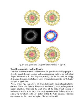 Fig.29. Bio-grams and Diagrams characteristic of type 1.
Type II (Apparently Healthy Peron).
The most common type of luminescence for practically healthy people. A
slightly indented outer contour and non-aggressive patterns on individual
fingers characterize it. The diagram partially lies in the zone of energy
deficiency. Expressed imbalance. Level of stress (activation) 3<A<6. Sector
analysis is applicable.
People of this type live active, full lives, but usually have subacute chronic
diseases that require therapy. There are a number of systems and organs that
require attention. These are the weak areas of the body, which in case of
unfavorable strain, acute stress, can cause symptoms and inflammation. As
a rule, we pay attention to all 4 pillars of the Bio-Well analysis. The most
common areas of focus are the spine, GI tract and thyroid.
 