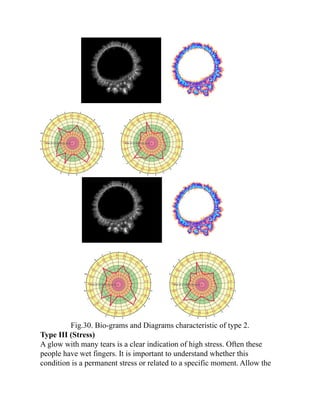 Fig.30. Bio-grams and Diagrams characteristic of type 2.
Type III (Stress)
A glow with many tears is a clear indication of high stress. Often these
people have wet fingers. It is important to understand whether this
condition is a permanent stress or related to a specific moment. Allow the
 