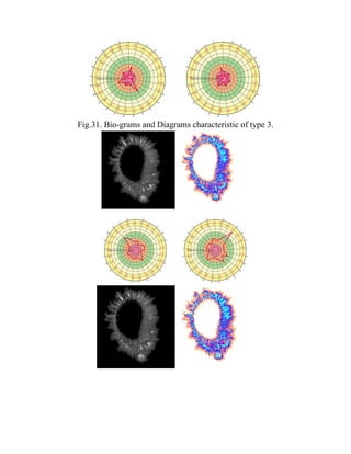 Fig.31. Bio-grams and Diagrams characteristic of type 3.
 