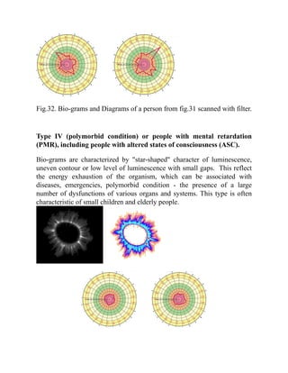 Fig.32. Bio-grams and Diagrams of a person from fig.31 scanned with filter.
Type IV (polymorbid condition) or people with mental retardation
(PMR), including people with altered states of consciousness (ASC).
Bio-grams are characterized by "star-shaped" character of luminescence,
uneven contour or low level of luminescence with small gaps. This reflect
the energy exhaustion of the organism, which can be associated with
diseases, emergencies, polymorbid condition - the presence of a large
number of dysfunctions of various organs and systems. This type is often
characteristic of small children and elderly people.
 