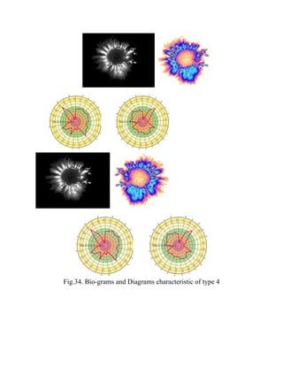Fig.34. Bio-grams and Diagrams characteristic of type 4
 